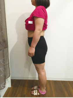 骨盤矯正の施術前