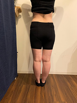 骨盤矯正の施術前