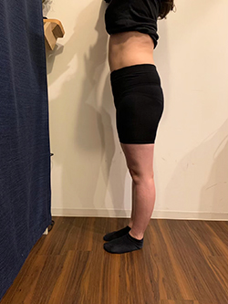 骨盤矯正の施術前