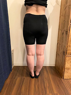 骨盤矯正の施術前