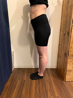 骨盤矯正の施術前