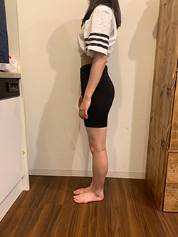 骨盤矯正の施術前