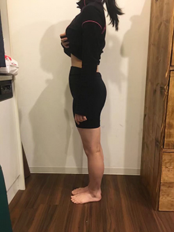 骨盤矯正の施術前