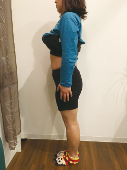 骨盤矯正の施術前