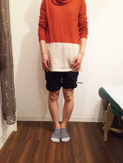 美脚調整前の写真