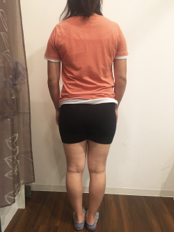 産後骨盤矯正の施術前